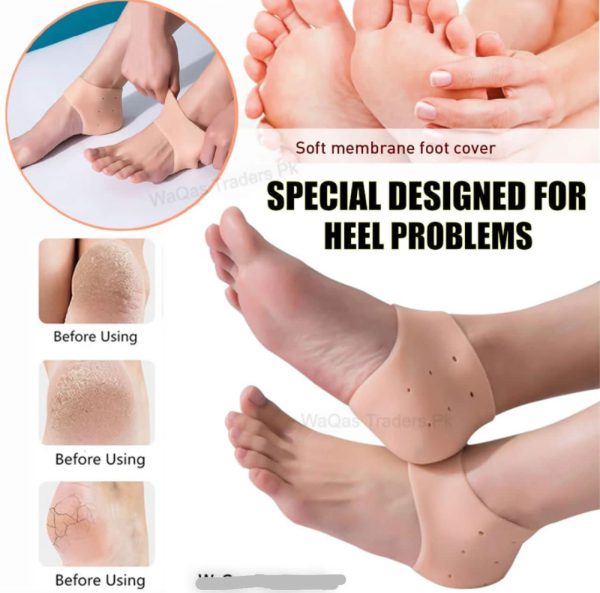 Half Heel Pain Anti-crack Silicone Set